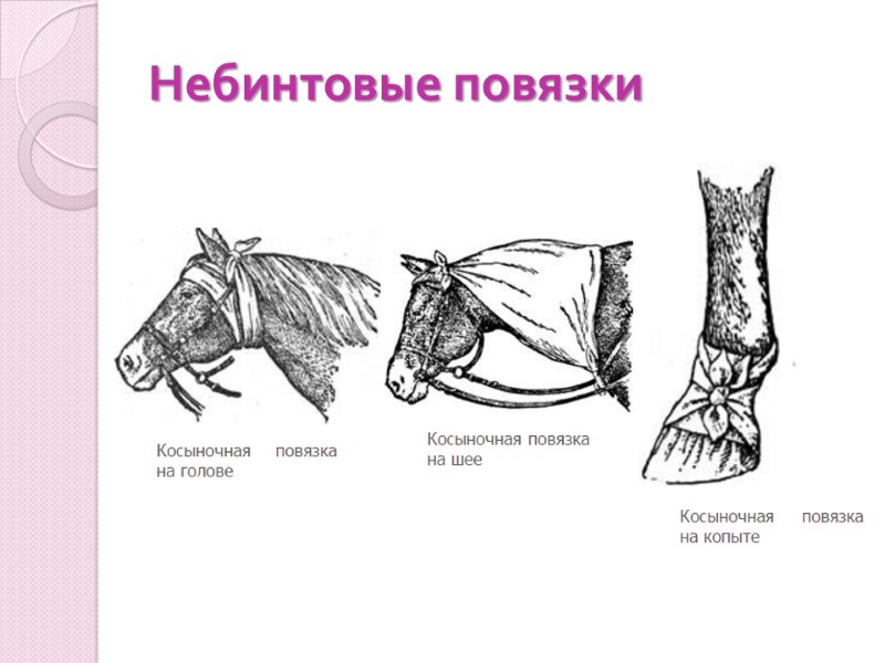 Небинтовые повязки